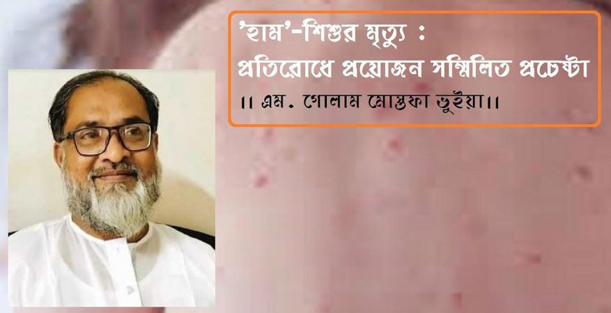 হাম'-শিশুর মৃত্যু : প্রতিরোধে প্রয়োজন সম্মিলিত প্রচেষ্টা